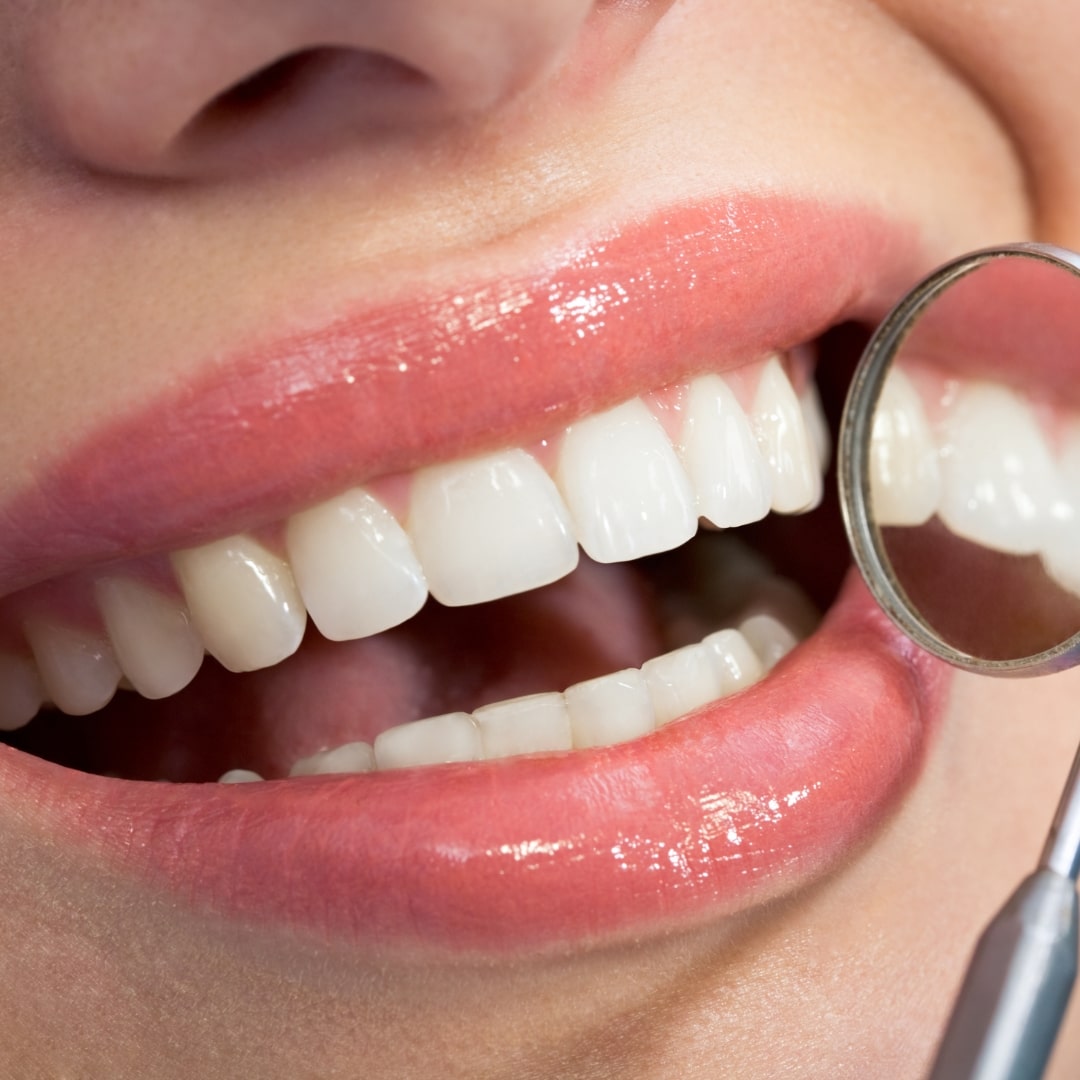 Pearl Smile Bromley Cross | Finance Options